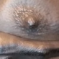 Teilbrust, Vollguss, in Silber gehalten, individuell angefertigter Rahmen mit silberfarbener Marmorierung.